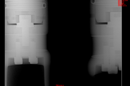 Insulating Basin - Crack Defect 03