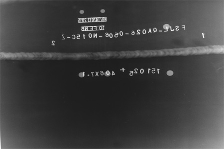X ray image 02